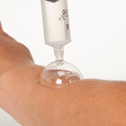 Wound Irrigation Shield Disposable, Plastic, Sterile (973944_EA)