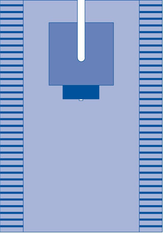 Medline EENT Split Drape, Sterile, 78" x 121", 8/CS (DYNJP7001)