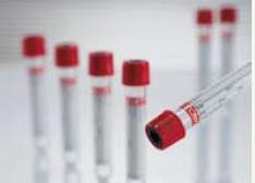 VACUETTE® Z Serum Clot Activator Venous Blood Collection Tube Clot Activator Additive 9 mL Pull Cap Polyethylene Terephthalate (PET) Tube (385924_EA)